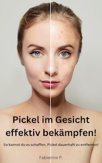Pickel im Gesicht effektiv bekämpfen! - Fabienne P. - E-Book