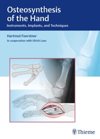 Osteosynthesis of the Hand - Hartmut Förstner - E-Book