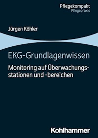 EKG-Grundlagenwissen - Jürgen Kohler - E-Book