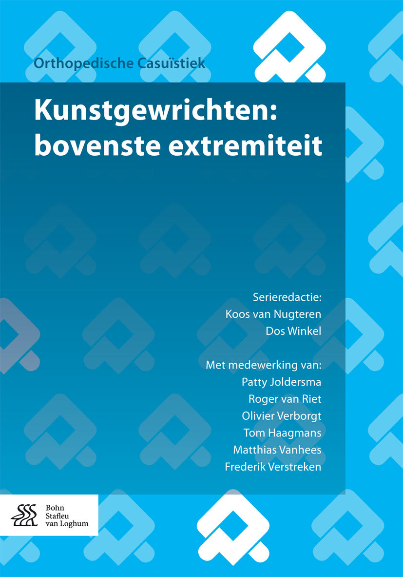 Kunstgewrichten: bovenste extremiteit - Koos van Nugteren - E-Book