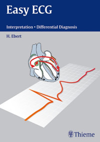 Easy ECG - Hans-Holger Ebert - E-Book