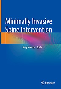 Minimally Invasive Spine Intervention -  - E-Book