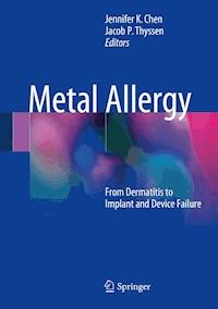 Metal Allergy -  - E-Book