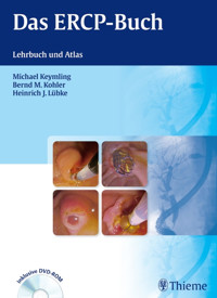 Das ERCP-Buch - Michael Keymling - E-Book