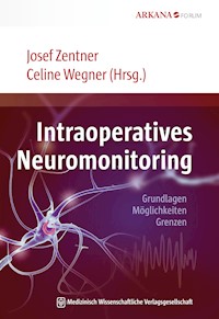 Intraoperatives Neuromonitoring - Josef Zentner - E-Book