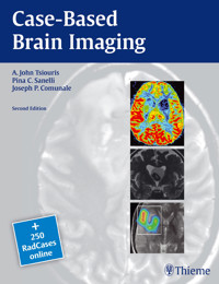 Case-Based Brain Imaging - A. John Tsiouris - E-Book