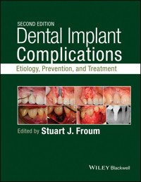 Dental Implant Complications -  - E-Book