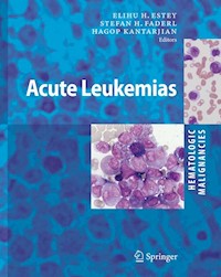 Hematologic Malignancies: Acute Leukemias -  - E-Book