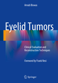 Eyelid Tumors - Arnab Biswas - E-Book