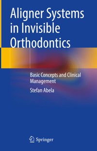 Aligner Systems in Invisible Orthodontics - Stefan Abela - E-Book