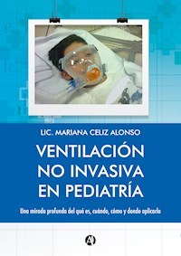 Ventilación no Invasiva en Pediatría - Mariana Celiz Alonso - E-Book