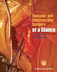 Vascular and Endovascular Surgery at a Glance - Morgan McMonagle - E-Book