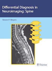Differential Diagnosis in Neuroimaging: Spine -  - E-Book
