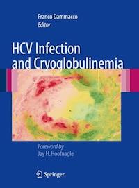 HCV Infection and Cryoglobulinemia -  - E-Book