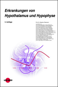 Erkrankungen von Hypothalamus und Hypophyse - Stephan Petersenn - E-Book