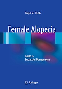 Female Alopecia - Ralph M. Trüeb - E-Book