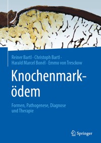 Knochenmarködem - Reiner Bartl - E-Book
