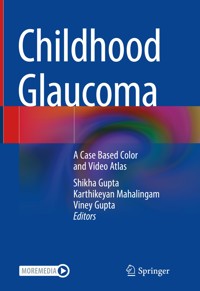 Childhood Glaucoma -  - E-Book