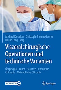 Viszeralchirurgische Operationen und technische Varianten - - E-Book