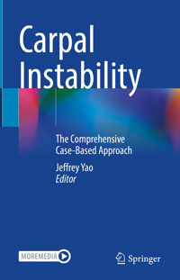 Carpal Instability -  - E-Book
