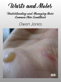 Warts And Moles - Owen Jones - E-Book