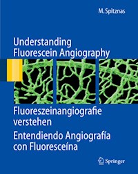 Understanding Fluorescein Angiography, Fluoreszeinangiografie verstehen, Entendiendo Angiografía con Fluoresceína - Manfred Spitznas - E-Book
