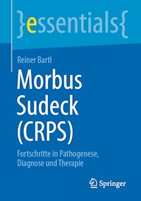 Morbus Sudeck (CRPS) - Reiner Bartl - E-Book