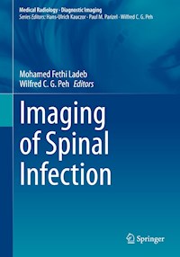 Imaging of Spinal Infection - - E-Book