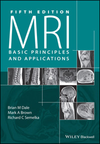 MRI - Brian M. Dale - E-Book