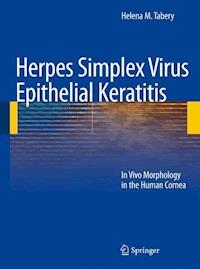 Herpes Simplex Virus Epithelial Keratitis - Helena M. Tabery - E-Book