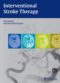 Interventional Stroke Therapy - Olav Jansen - E-Book