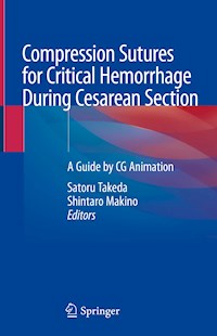 Compression Sutures for Critical Hemorrhage During Cesarean Section -  - E-Book