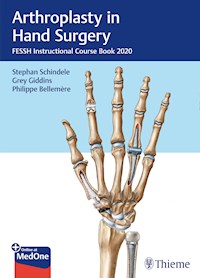 Arthroplasty in Hand Surgery -  - E-Book