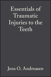 Essentials of Traumatic Injuries to the Teeth - Jens O. Andreasen - E-Book