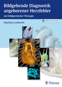 Bildgebende Diagnostik angeborener Herzfehler -  - E-Book