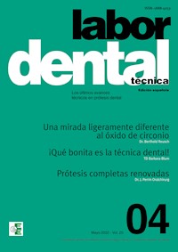 Labor Dental Técnica Nº4 Vol.25 - - E-Book