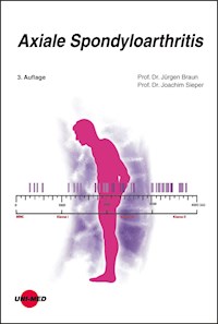 Axiale Spondyloarthritis - Jürgen Braun - E-Book