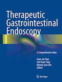 Therapeutic Gastrointestinal Endoscopy -  - E-Book