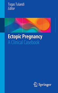 Ectopic Pregnancy -  - E-Book