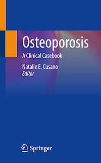 Osteoporosis -  - E-Book