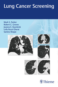 Lung Cancer Screening - Mark Parker - E-Book