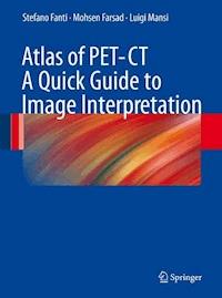 Atlas of PET-CT - Stefano Fanti - E-Book