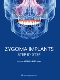 Zygoma Implants - Arun K. Garg - E-Book
