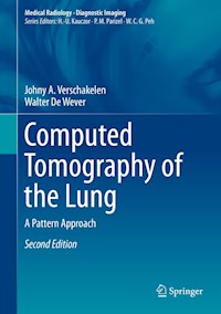 Computed Tomography of the Lung - Johny A. Verschakelen - E-Book