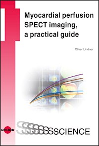 Myocardial perfusion SPECT imaging, a practical guide - Oliver Lindner - E-Book