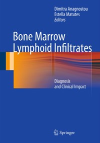 Bone Marrow Lymphoid Infiltrates -  - E-Book