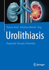 Urolithiasis -  - E-Book