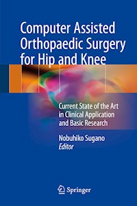 Computer Assisted Orthopaedic Surgery for Hip and Knee - - E-Book