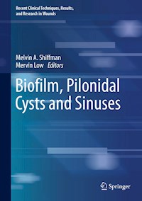 Biofilm, Pilonidal Cysts and Sinuses - - E-Book