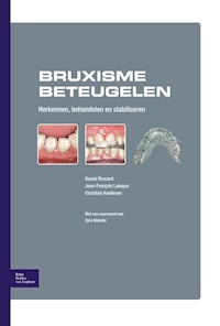 Bruxisme beteugelen - BSL - E-Book